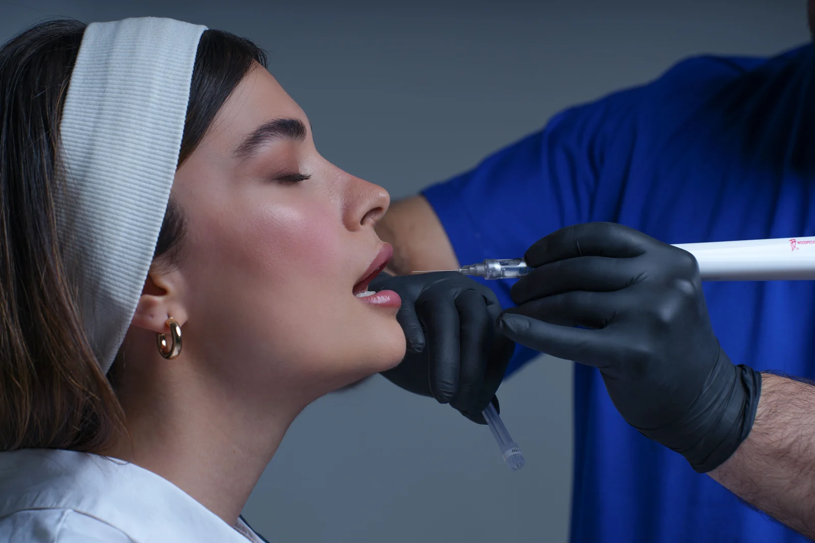 Lip filler treatment with a fine needle